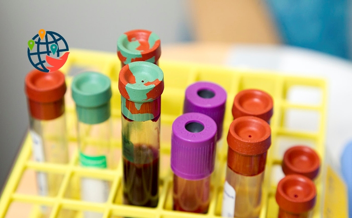 Canadá aprueba las pruebas individuales del VIH
